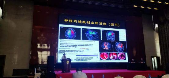 【莱沃医疗】热烈庆祝中国神经内镜微创治疗高血压脑出血技术推广会顺利召开